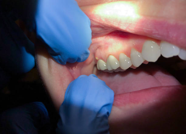 Best Mobile Emergency Dentist in Kingston, TN